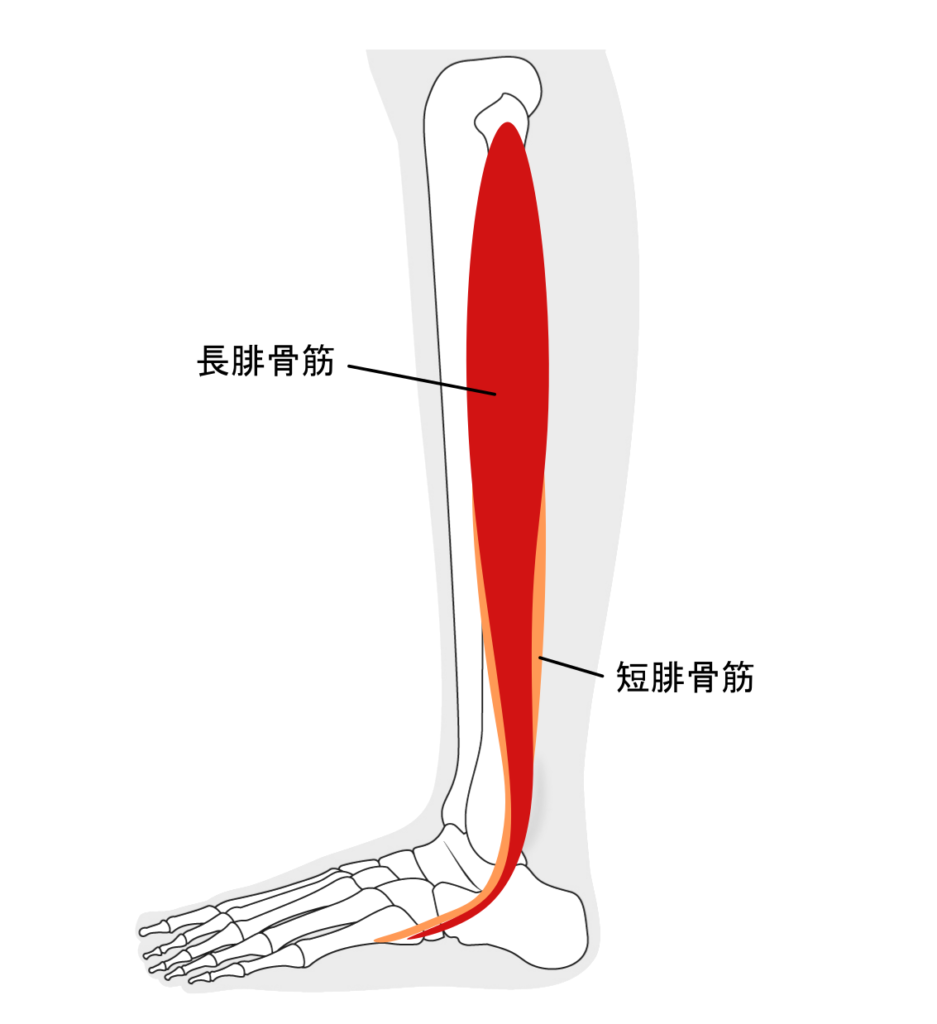 腓骨筋腱炎の説明イラスト