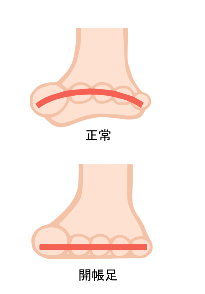 開帳足のイラスト